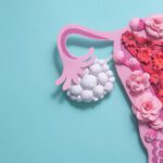 Concept,Polycystic,Ovary,Syndrome,,Pcos,Awareness.,Women,Reproductive,System.,Paper